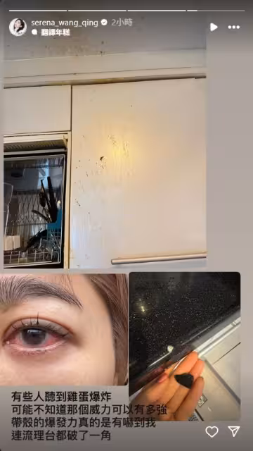 王晴微波雞蛋炸傷眼「流理台也炸碎」! 難忍角膜破裂疼痛:快昏去