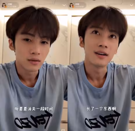 28歲前韓團成員驚傳「頭部長腫瘤」! 認8月剃髮開刀:有段時間了