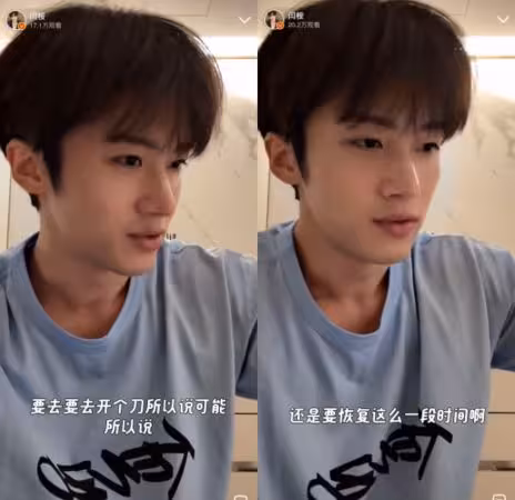 28歲前韓團成員驚傳「頭部長腫瘤」! 認8月剃髮開刀:有段時間了
