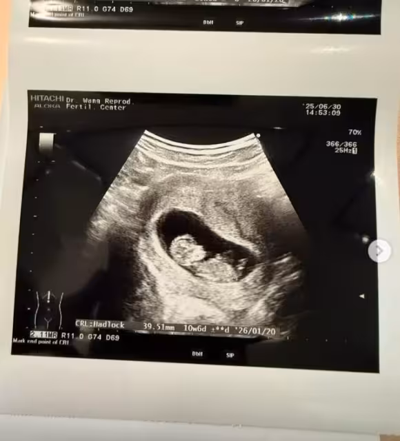 快訊/嚴爵結婚4年...終於要當爸爸了! 「試管拼2年」父親節報喜