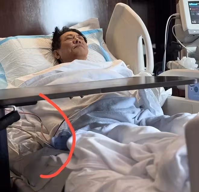 李連杰手術過程曝光，價值兩億佛珠不離手，網友評論一針見血