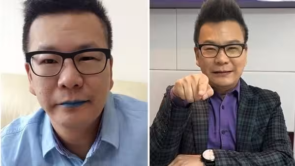 沈玉琳「每年都高階健檢」仍驗不出血癌！1徵兆太尋常：出現就是得病了