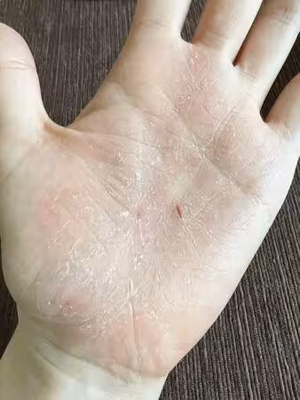 張靚穎健康亮紅燈!伸懶腰就滲血 額頭詭異突一條「查不出原因」