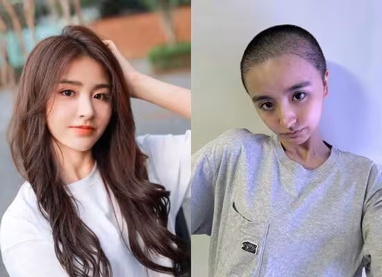 《青春有你2》女星退圈4個月突剃光頭!172cm暴瘦剩45kg 粉憂近況