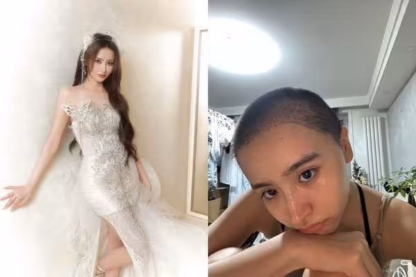 《青春有你2》金子涵被發現「手腕多條疤」 狀況引網憂:別傷害自己