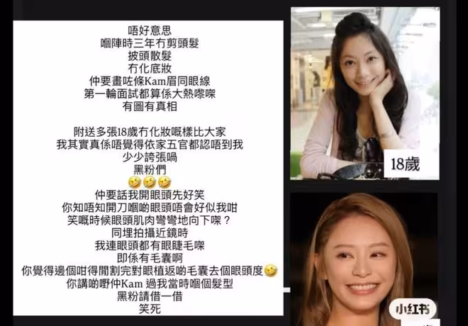 TVB港姐小花爆紅後被質疑整容！大曬18歲素顏照反擊！透露與緋聞男友近況
