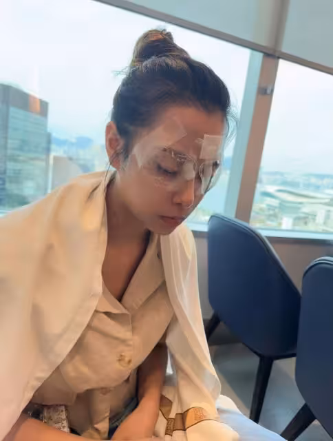 TVB東張女神爆手術失敗又重做!上月遇車禍以為要沒命!感嘆流年不利!