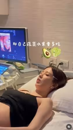 愛雅懷孕5個月「3部位變黑了」!崩潰吐最尷尬問題:以前從沒遇過
