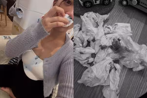 玉兔卸貨倒數「氣到狂流鼻血」! 血崩畫面嚇壞尪:很怕一屍兩命