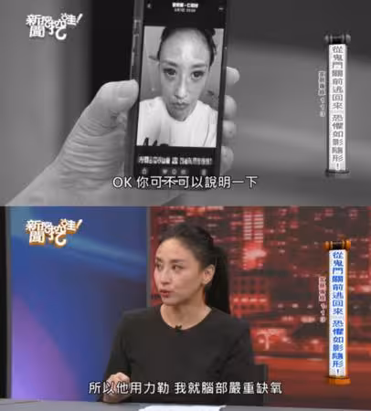 《星光》女星遭家暴照片曝光！　「雙眼充血」開打離婚官司