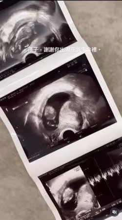 快訊／《全明星》黃沐妍結婚1月認了已懷孕！寶寶「陪跑3場馬拉松」超猛