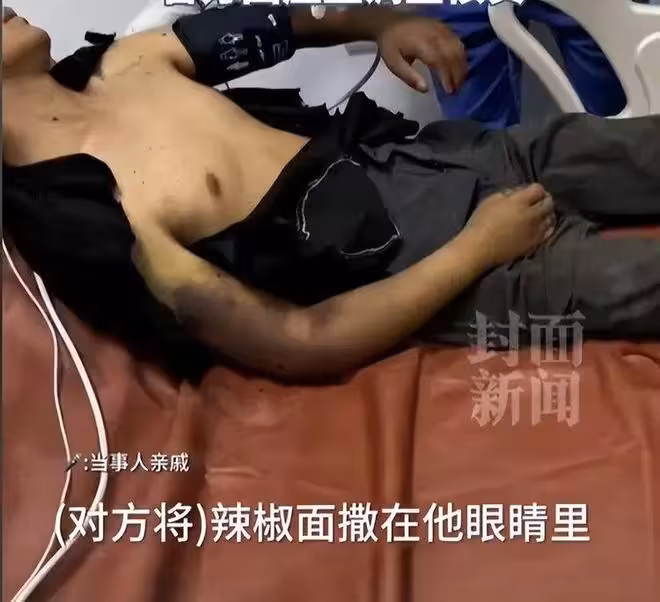 貴州網紅去非洲，被同胞拘禁打斷手腳，兇手發文洗白，警方介入