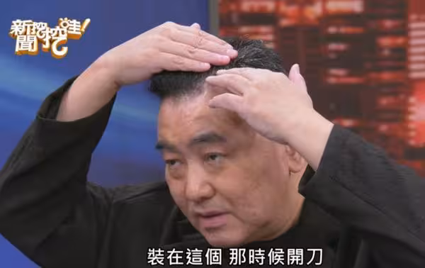 徐亨3cm腦瘤「腦內積水排不掉」!摘除恐半身不遂 頭皮裝1裝置活命
