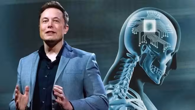 馬斯克腦機接口手術提速至1.5秒!萬人排隊爭做「賽博格」