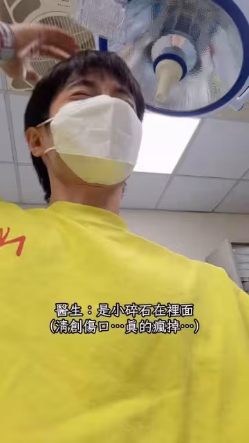阿本出外景踩到石頭「直接插進腳底板」 崩潰清創:痛到失去靈魂