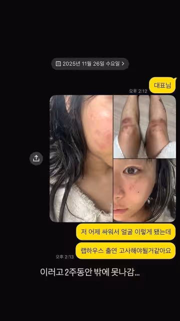 全身傷痕累累!韓女星控前男友軟禁掐頸 淚訴:公開才能結束