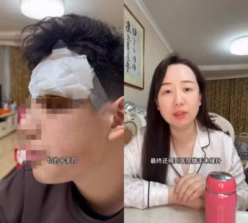 女星幫兒挑痘出事! 害感染「進手術室縫4針」自責:心如刀割