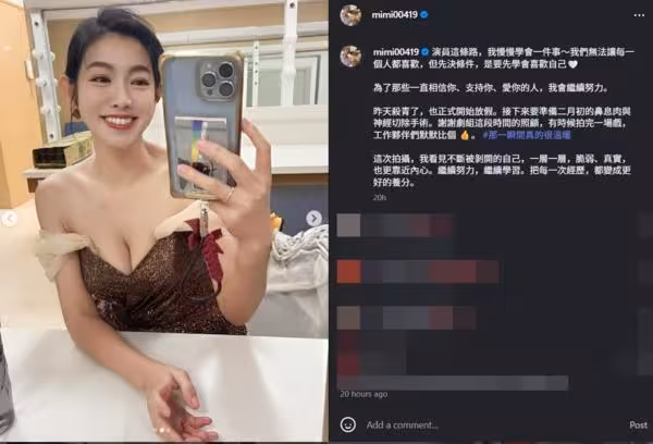 米可白殺青突宣布動刀!預告「切除神經」 認了:每天頭痛不舒服
