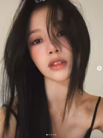 蔡瑞雪突PO「脖子紅腫照」!厚敷藥膏慘況曝 認了確診這病症:治療中