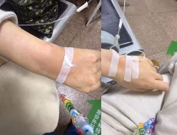 陸女星吃藥引心悸!手腫如豬蹄 嘆「跟誰過都一樣」掀揣測