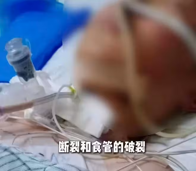 震驚！13歲少年騎車被繩索割喉，生死一線！