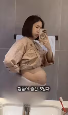 韓國女偶像「順產雙胞胎」卸貨5天後⋯　肚皮驚人狀態曝：很衝擊