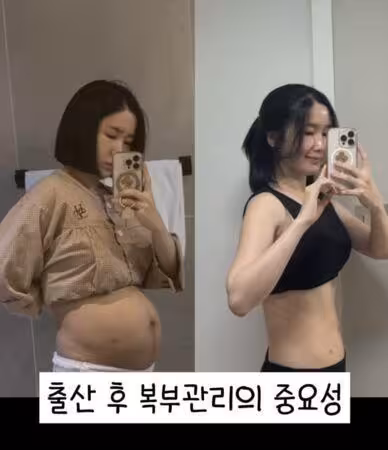 韓國女偶像「順產雙胞胎」卸貨5天後⋯　肚皮驚人狀態曝：很衝擊