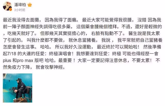 潘瑋柏自爆「顏面神經失調」　認右臉動不了：吃很多藥