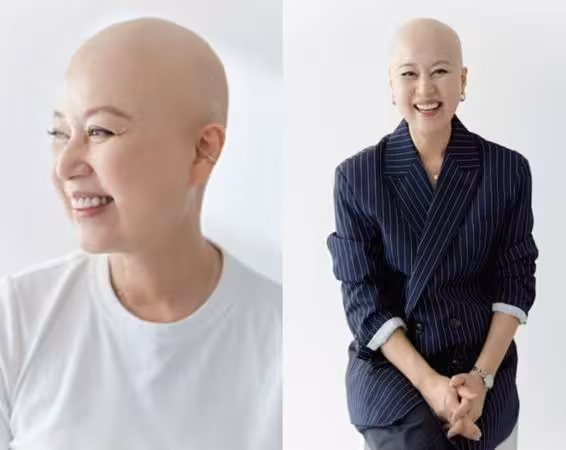 《順風婦產科》朴美善「癌細胞轉移淋巴」化療16次現狀曝光