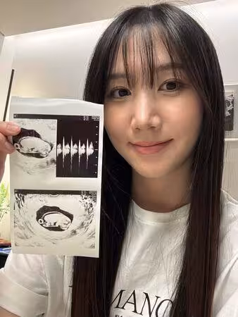 前Apink洪瑜暻宣布當媽！　結婚3年喜曬超音波照