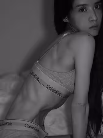 阿沁辣妻PO「暴瘦剩骨頭」素顏照!得厭食症2年後近況曝:放過自己