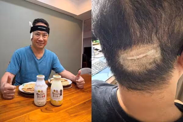 楊月娥家中深夜傳巨響! 驚見「老公摔破頭」傷照曝:手掌都是血