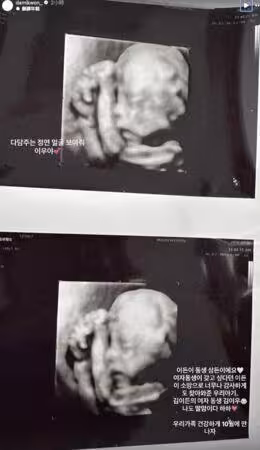 GD家迎來喜訊!小公主即將出生 親姊證實「懷二胎」:10月見唷