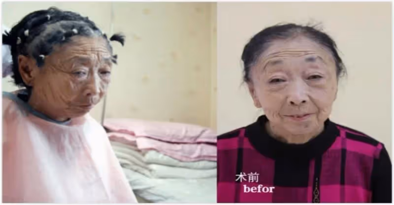 71歲阿嬤為了嫁給年輕帥哥，傾盡家財跑去「整型成30歲少婦」，變化超大！