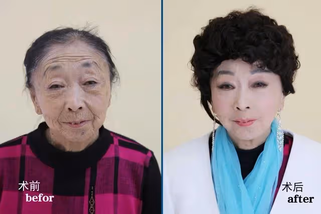 71歲阿嬤為了嫁給年輕帥哥，傾盡家財跑去「整型成30歲少婦」，變化超大！