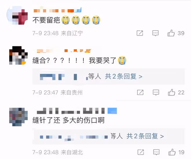 楊冪錄製節目意外受傷!被緊急送醫縫合眼角,節目組發文道歉