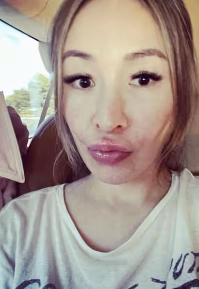 蕭亞軒曬素顏照曝臉上傷疤　網力挺：依然是女神！