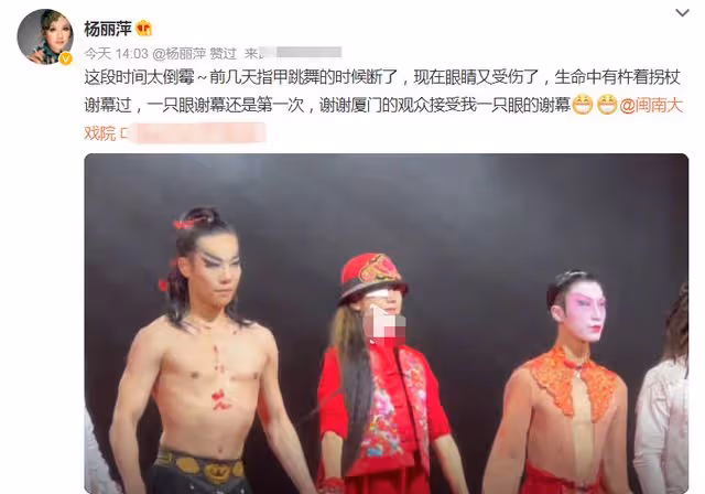 63歲楊麗萍太敬業！指甲折斷後右眼再受傷，纏紗布上台謝幕引熱議