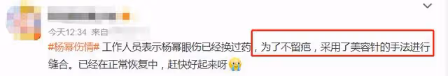 楊冪父親回應女兒傷勢！直言感謝老天保佑，女兒受傷三天操碎了心