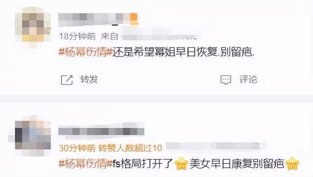 楊冪父親回應女兒傷勢！直言感謝老天保佑，女兒受傷三天操碎了心