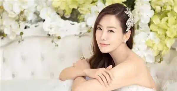 當年被李瑞鎮媽媽嫌棄的金廷恩，嫁富豪後復出，變臉整容太僵硬