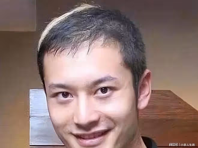 明星也有禿頭煩惱?黃曉明的假髮套,趙麗穎的脫髮煩惱說明一切