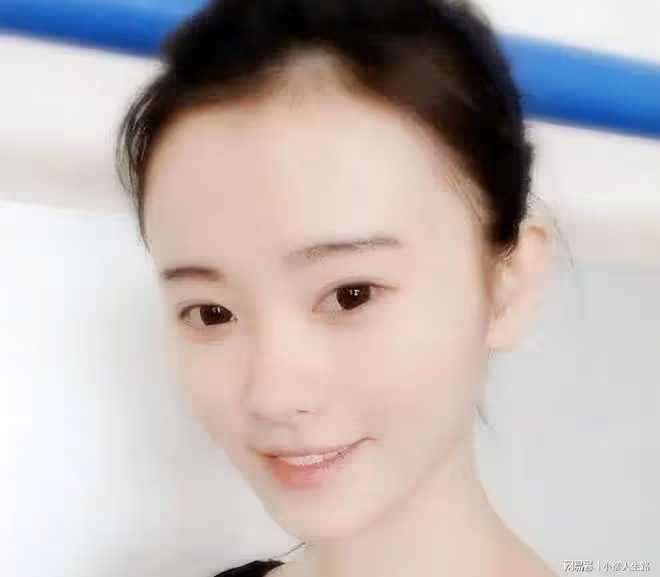 明星也有禿頭煩惱?黃曉明的假髮套,趙麗穎的脫髮煩惱說明一切