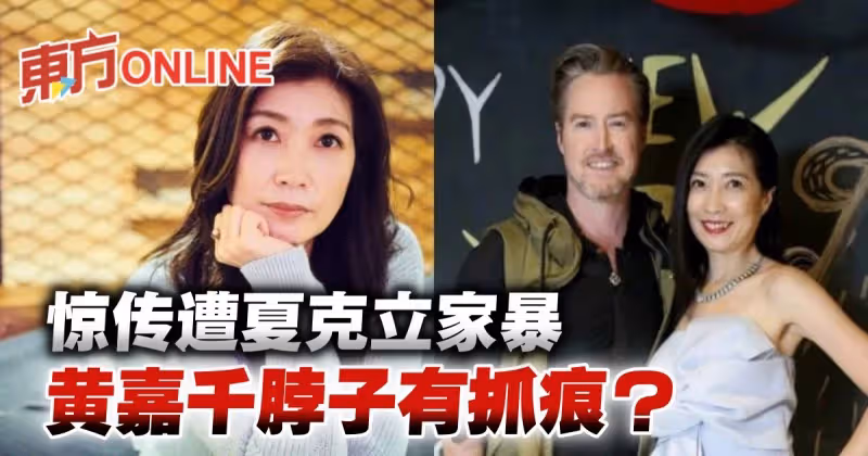 黃嘉千驚傳遭夏克立家暴「脖子有抓痕」？！