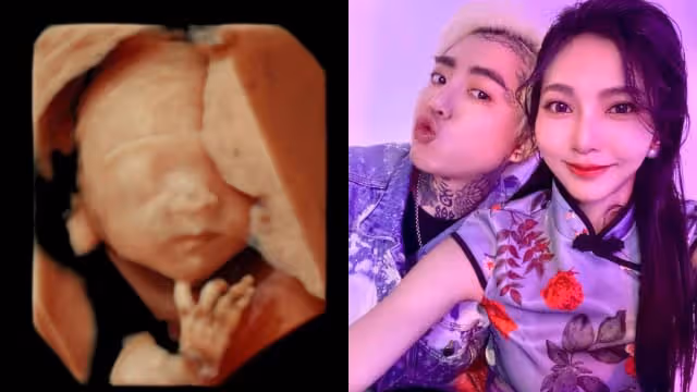 曬超音波照　謝和弦公布寶寶性別