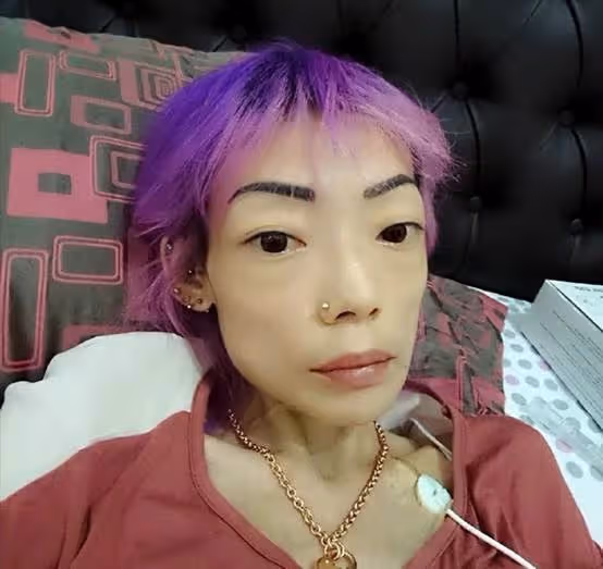 瘦成皮包骨、青筋凸出,8位脫相式衰老的女星,今昔對比差距大