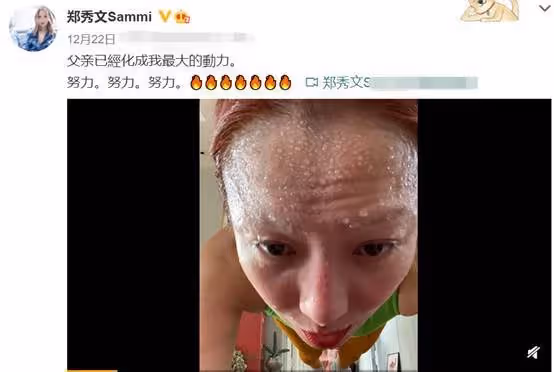 瘦成皮包骨、青筋凸出,8位脫相式衰老的女星,今昔對比差距大