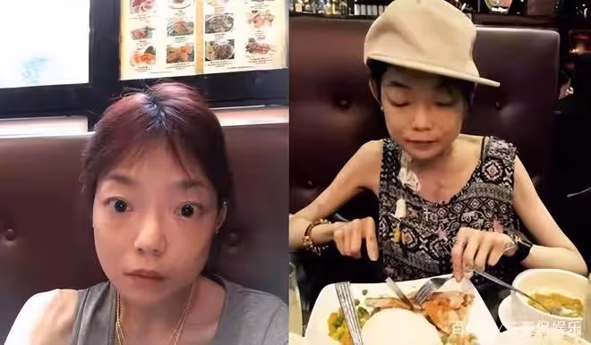 瘦成排骨、動臉成癮、切胃洗腸一起上,女明星的畸形審美太可怕了