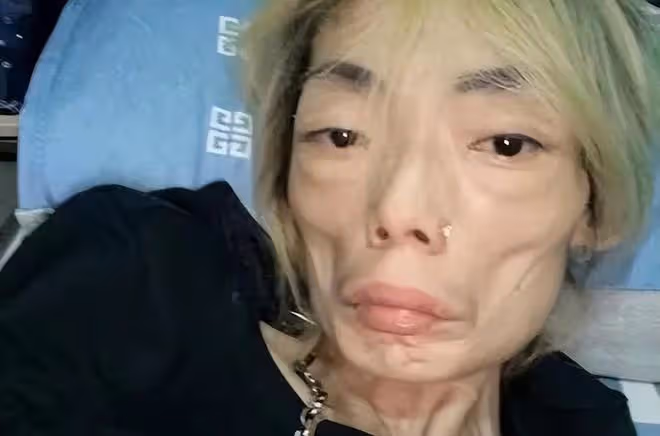 瘦成排骨、動臉成癮、切胃洗腸一起上,女明星的畸形審美太可怕了