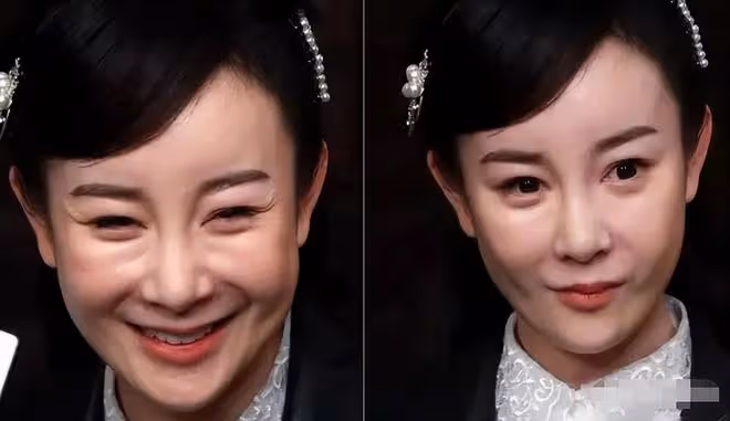 瘦成排骨、動臉成癮、切胃洗腸一起上,女明星的畸形審美太可怕了